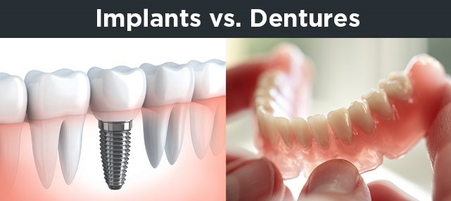 Front Teeth Dentures Odessa TX 79760